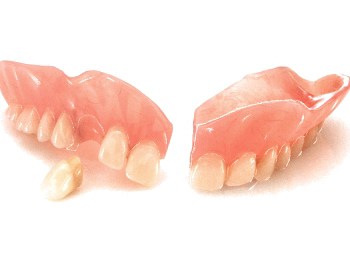 Gebroken gebit behandeling tandlabo dentuelle delaruelle zelzate